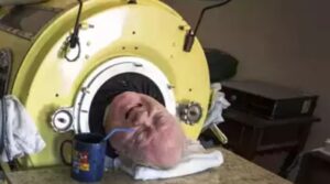 Paul Alexander: 'Man in the iron lung' dies at the age of 78