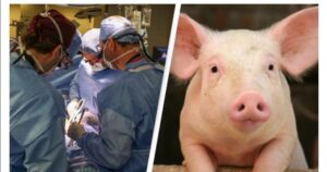 Pig Kidney Transplanted into Living Human for First Time