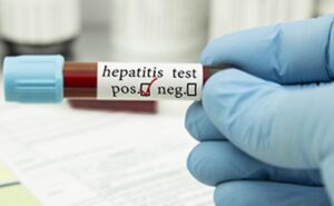 India has second-most hepatitis B, C cases after China: WHO report